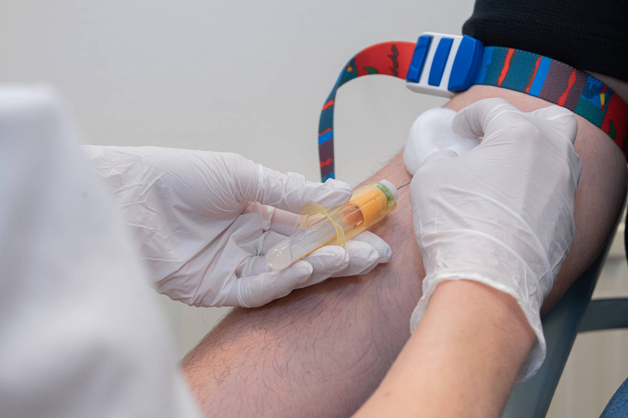 Koje laboratorijske pretrage treba raditi jednom godišnje – vodič za prevenciju zdravlja